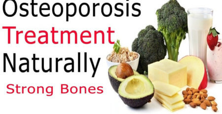 healthy bones, osteoporosis treatment, treatment of osteoporosis