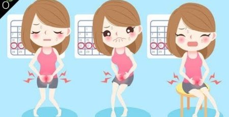 premenstrual syndrome (PMS), symptoms of PMS, Premenstrual syndrome, Natural treatment of premenstrual syndrome (PMS), treatment of premenstrual syndrome